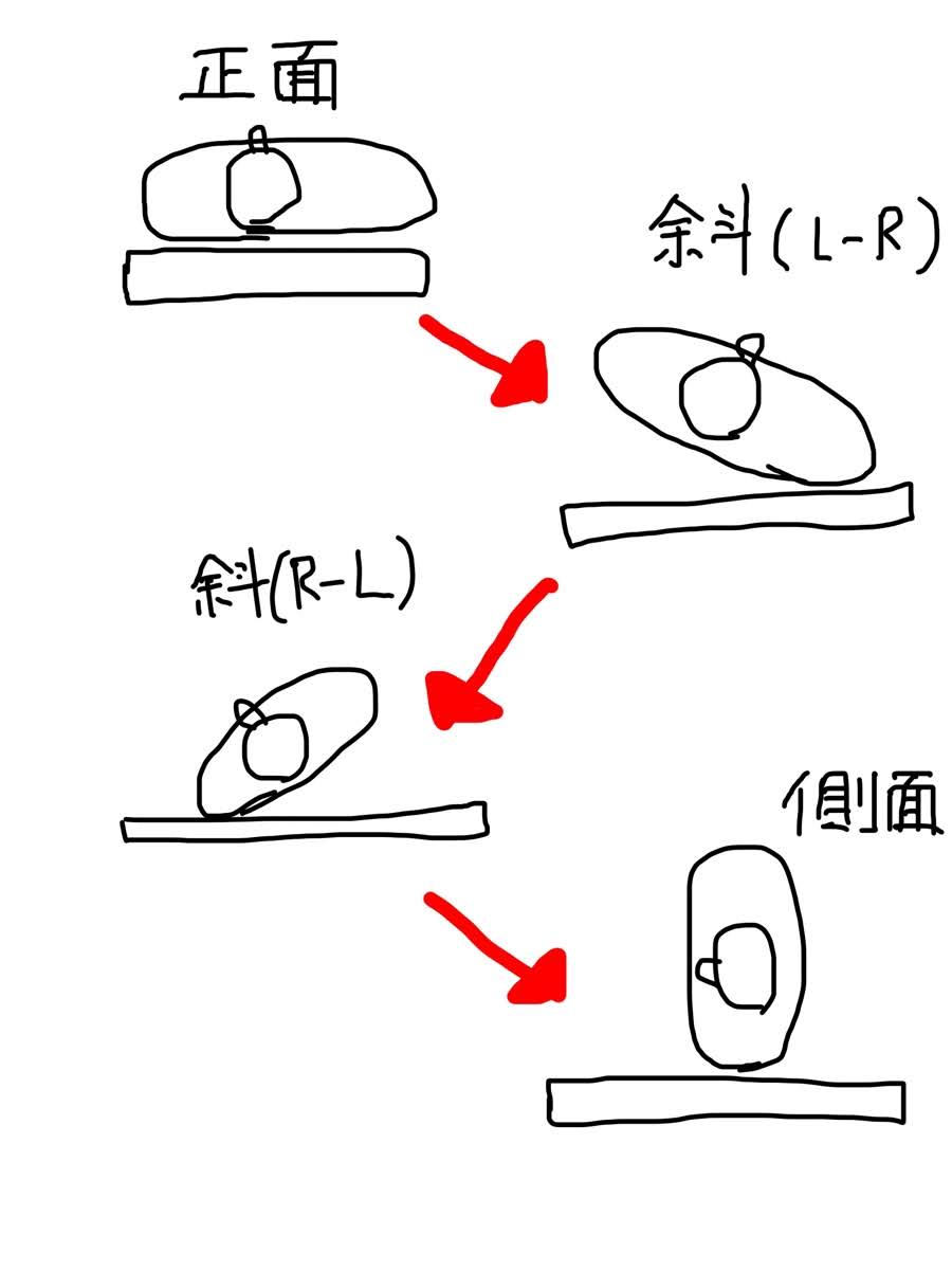 腰椎レントゲン斜位撮影 誰でも簡単にポジショニングができるコツを解説 放射線技師一年目の教科書